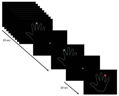 Pre-surgical fMRI Localization of the Hand Motor Cortex in Brain Tumors: Comparison Between Finger Tapping Task and a New Visual-Triggered Finger Movement Task